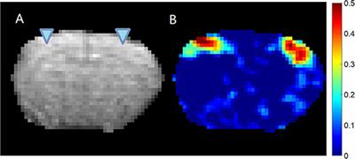 The Relationship Between Local Field Potentials and the Blood-Oxygenation-Level Dependent MRI Signal Can Be Non-linear